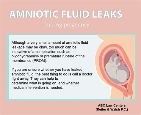 amniotic fluid sticky|Water Breaking: What Are the Signs of Leaking Amniotic Fluid